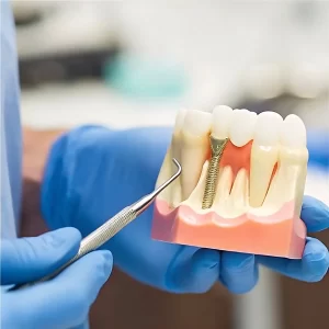 Her hasta implant tedavisi için uygun mudur? Kadıköy Diş Hekimi