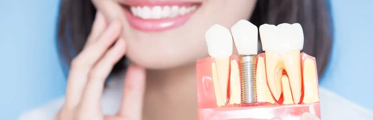 Her hastaya implant tedavisi yapılabilir mi? Kadıköy Diş Kliniği