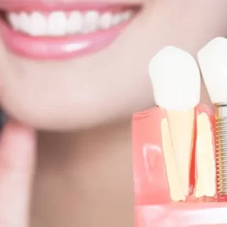 Her hastaya implant tedavisi yapılabilir mi? Kadıköy Diş Kliniği