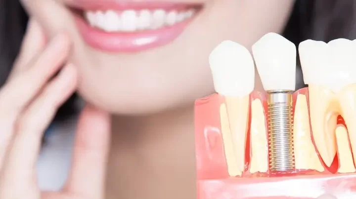 Her hastaya implant tedavisi yapılabilir mi? Kadıköy Diş Kliniği