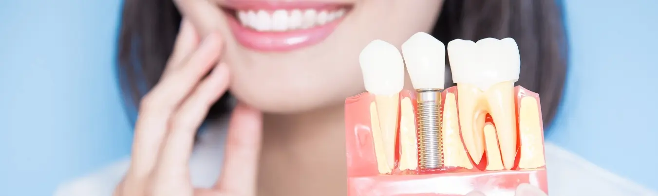 Her hastaya implant tedavisi yapılabilir mi? Kadıköy Diş Kliniği